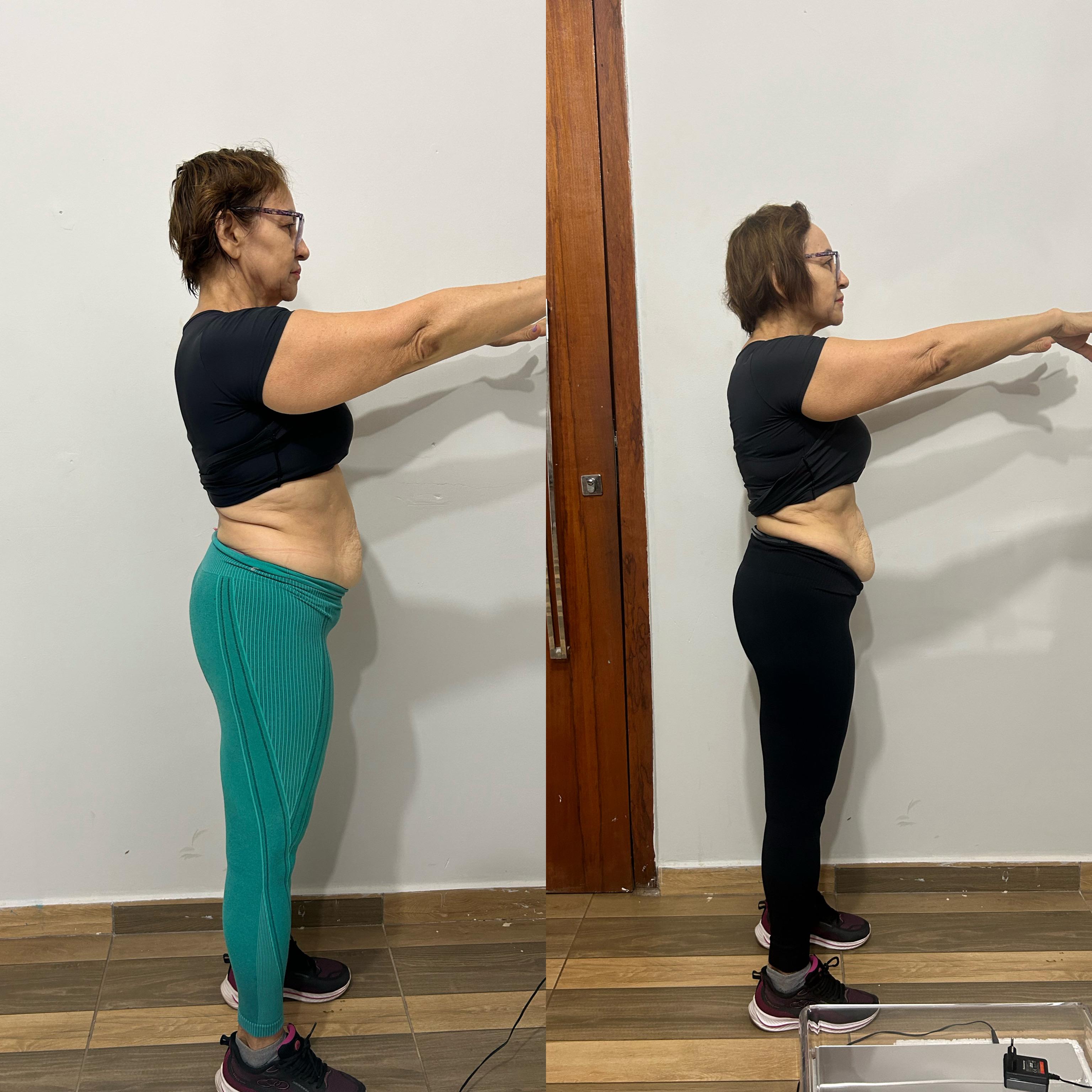 Transformação de Carla M.